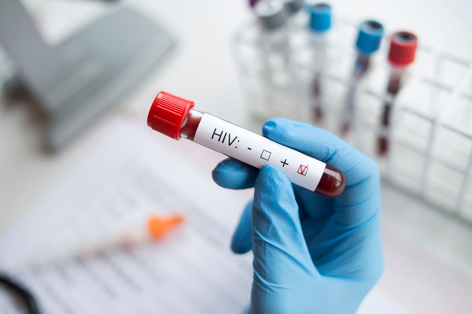 Трем женщинам поставили диагноз ВИЧ после процедур по уходу в Нью-Мексико